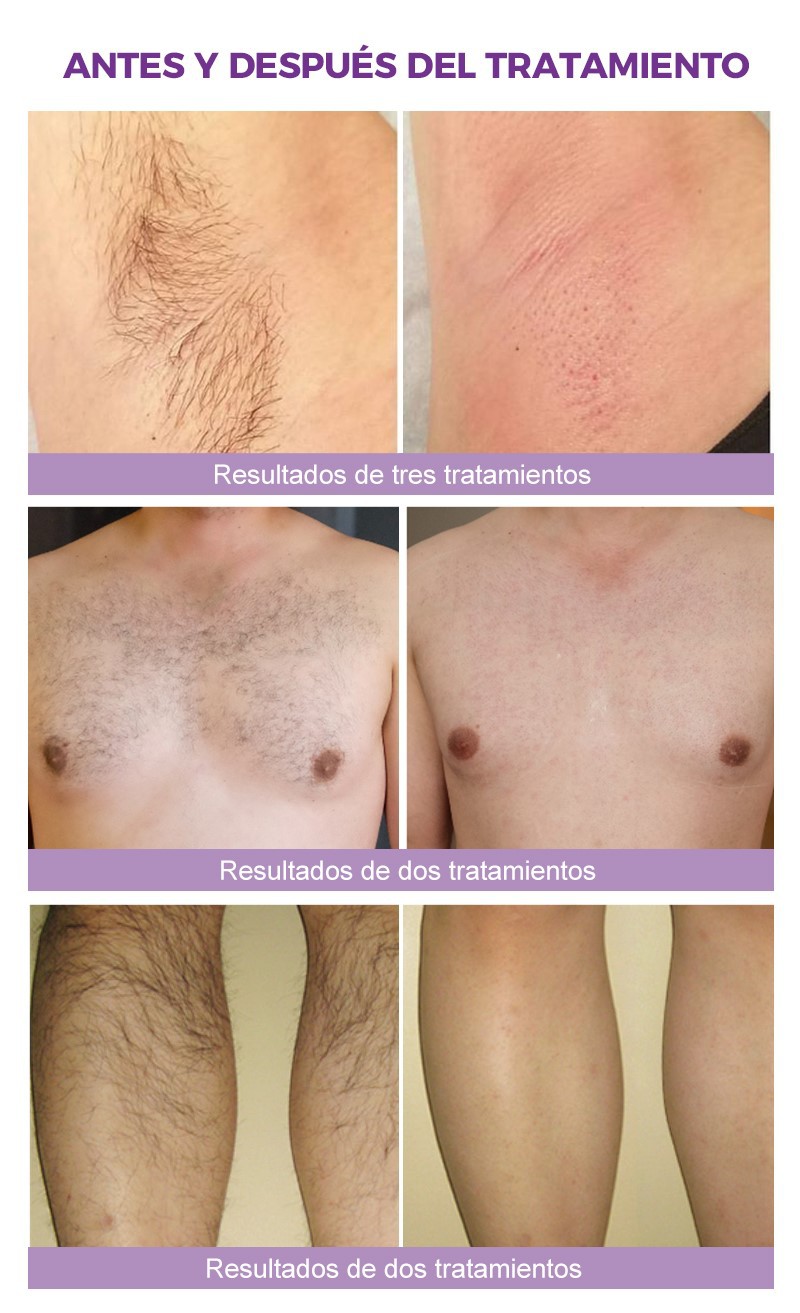 bm18-2---10 bm18-2---10